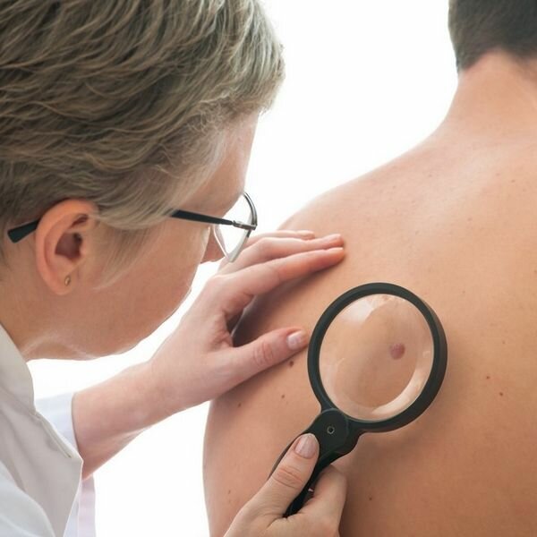 Дерматолог