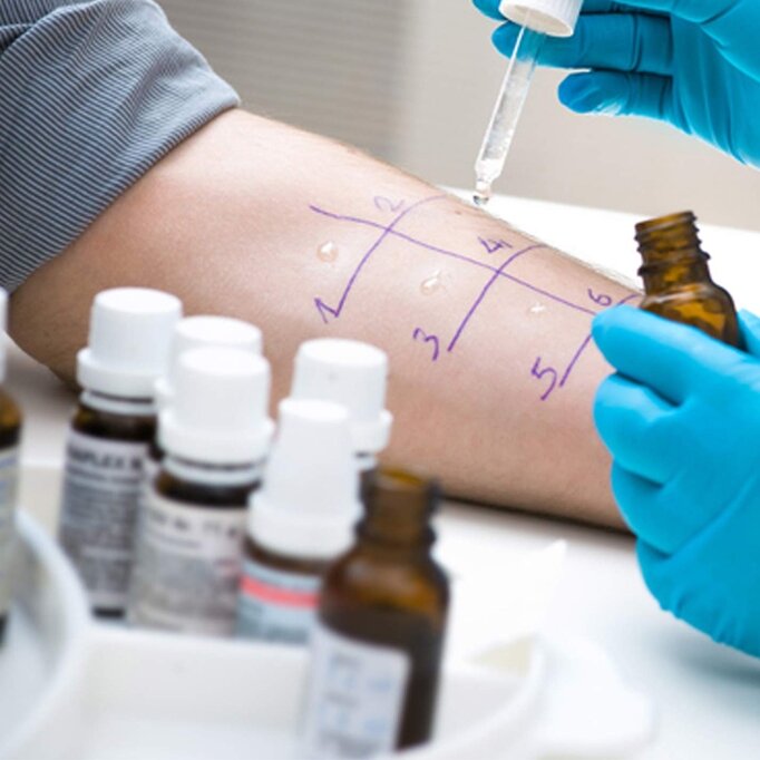 Аллерголог